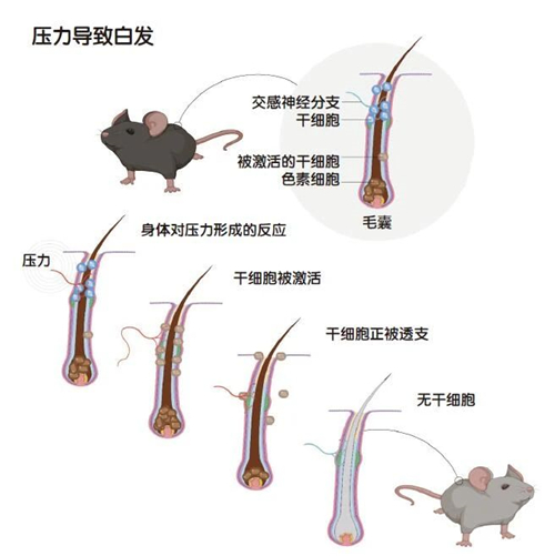 压力大为什么能导致白发