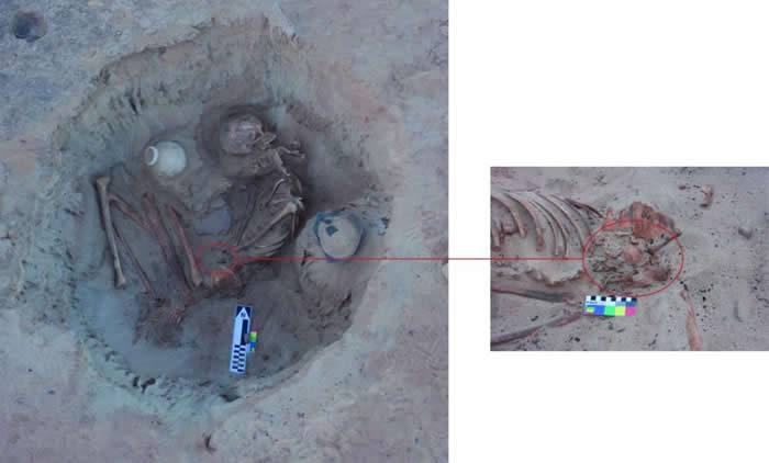 古埃及3700年前下葬的准妈妈可能提供关于古代世界存活率的线索