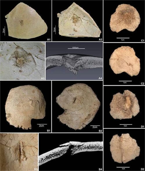 西班牙比利牛斯山脉El Trocs洞穴发现7300年前被残忍杀害的人类遗骸