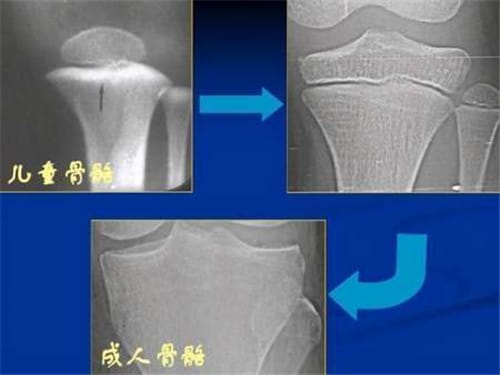 东方人和西方人祖先是同一个人吗