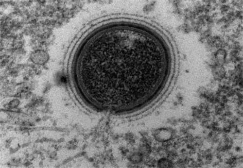 北极发现5万年前尸体永冻土锁不住史前超级病毒