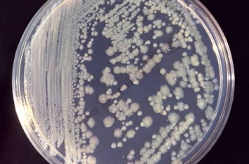 国际空间站发现肠杆菌菌株 研究它们避免对宇航员造成健康影响