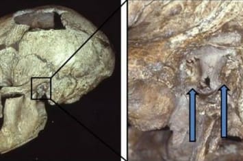 《PLoS One》：耳道内异常的骨质增生“游泳者耳病”在尼安德特人中非常普遍