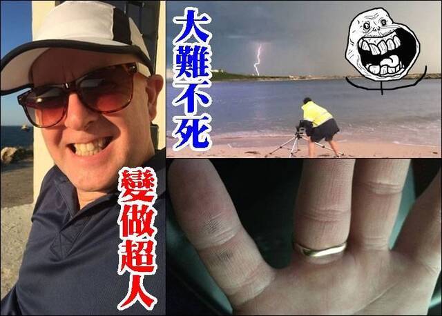 遇雷击不死变超人 澳洲男子拥有读心术