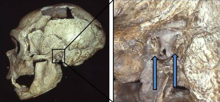 《PLoS One》：耳道内异常的骨质增生“游泳者耳病”在尼安德特人中非常普遍