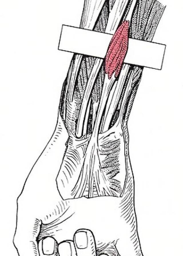 检查你手腕下有没有“掌长肌”突出来 有就证明你遗传到人类祖先留下来的礼物