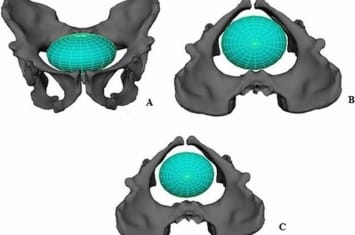 新研究称200万年前古人类生孩子“相当容易”