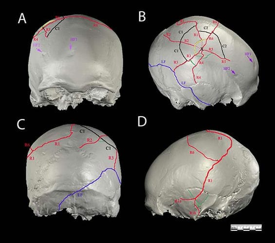 科学家侦破3万3000年前罗马尼亚洞穴谋杀案 男性被害人被左撇子用棍棒杀害