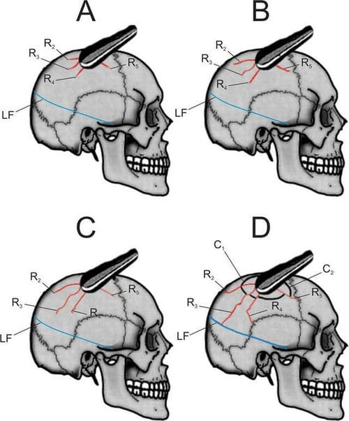 科学家侦破3万3000年前罗马尼亚洞穴谋杀案 男性被害人被左撇子用棍棒杀害